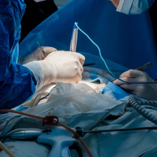 electrosurgery-blog
